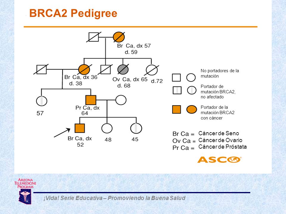 cáncer de próstata brca2 cáncer de próstata brca2